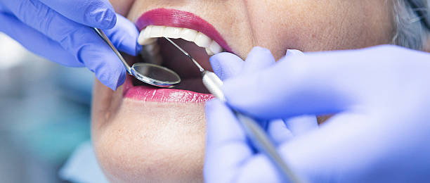 Best Emergency Broken Tooth Repair in Northumberland, PA